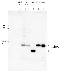 SbtA | Sodium-dependent bicarbonate transporter  in the group Antibodies Plant/Algal  / Photosynthesis  / Chaperones/Transporters at Agrisera AB (Antibodies for research) (AS13 2657)